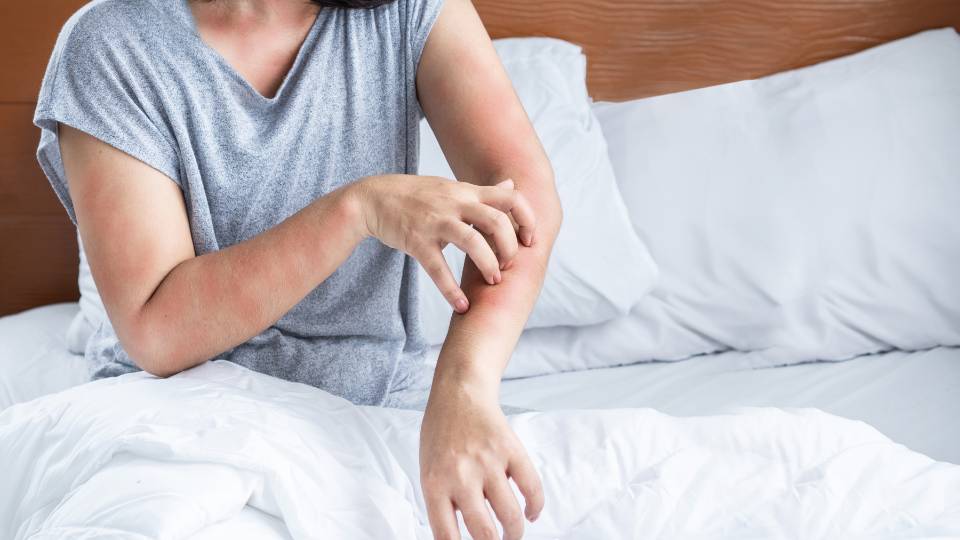 a hotel guest scratching at skin because of bed bug bites